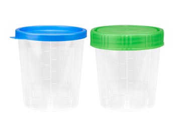 Urinbecher, Probengefässe